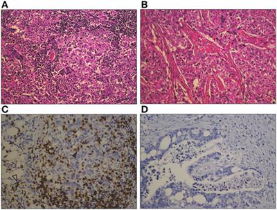 The Role of the Tumor Vasculature in the Host Immune Response: Implications for Therapeutic Strategies Targeting the Tumor Microenvironment